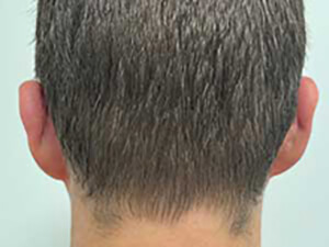 After
