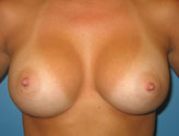 post-op