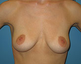 pre-op