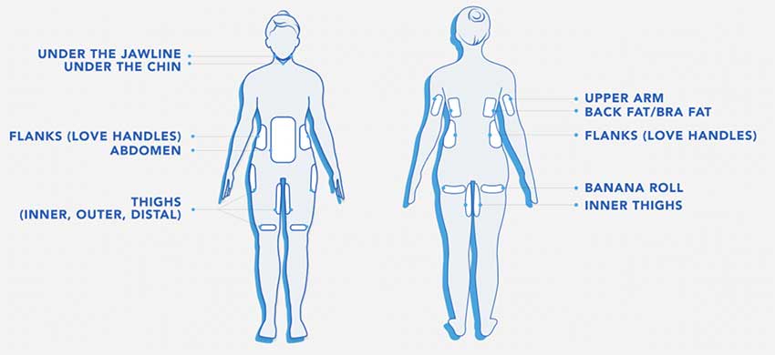 Coolsculpting Elite - Target Body Areas