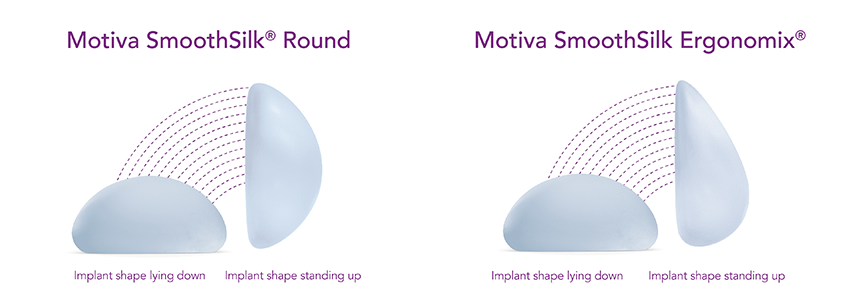 Motiva breast implants compared