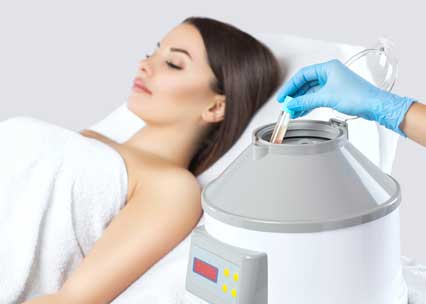 PRP Microneedling photo